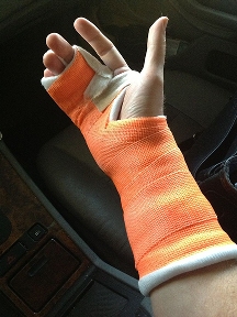 Mending broken arm